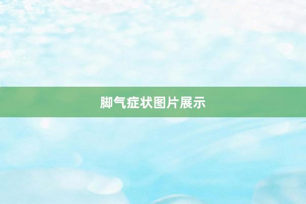 脚气症状图片展示